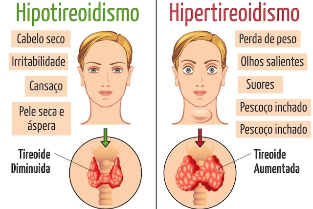 Água alcalina X doenças: Como prevenir sintomas